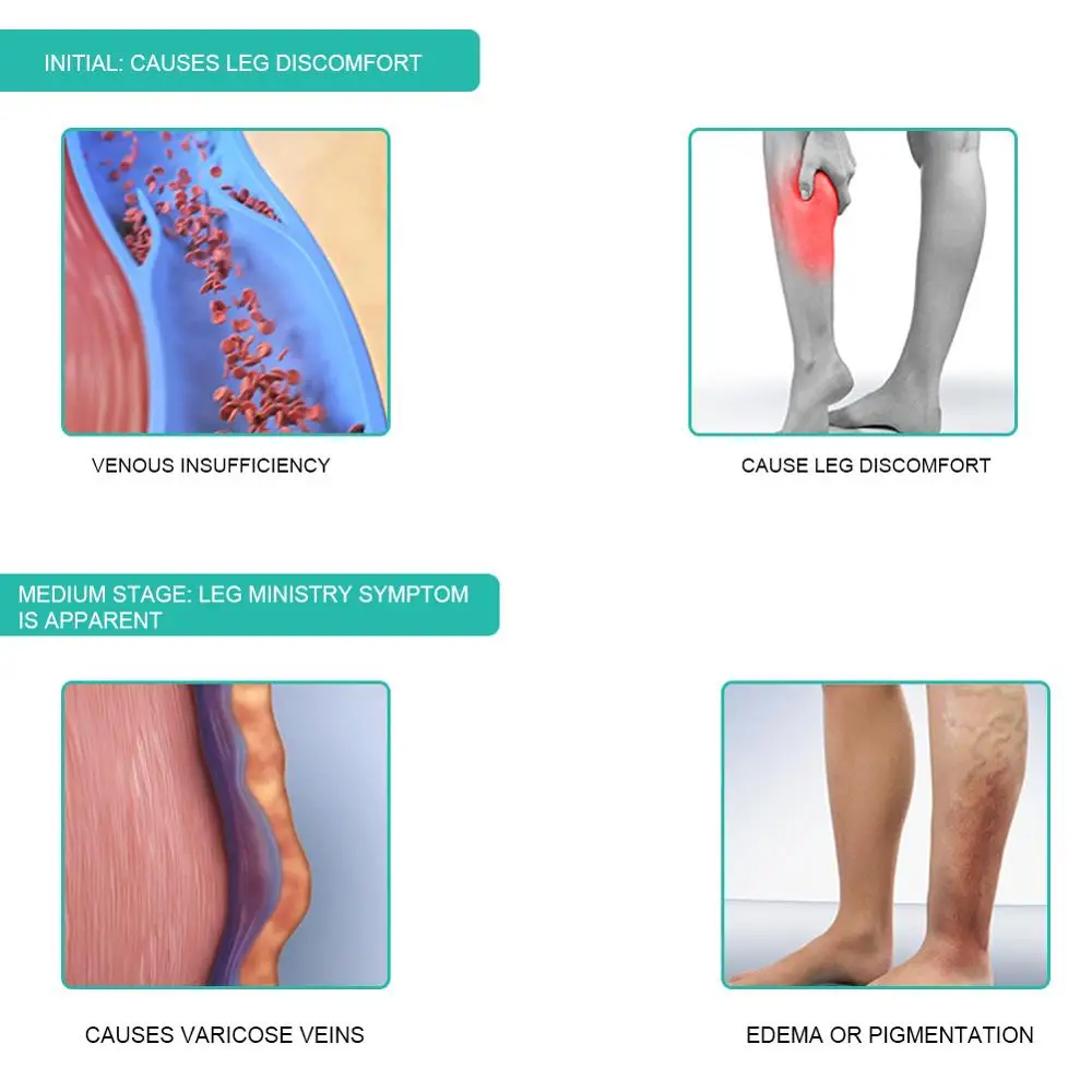 1 çift tıbbi varis çorabı 30-4 - Compression Sock Medical incelemesi ve fiyatı