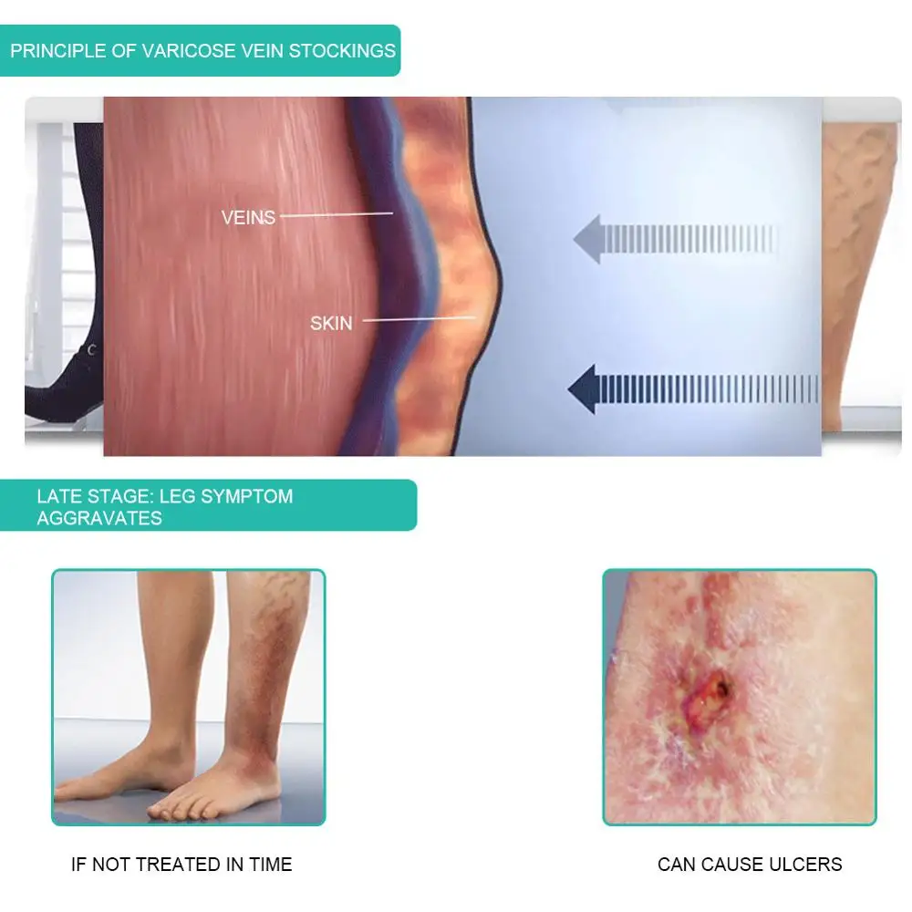 1 çift tıbbi varis çorabı 30-4 - Compression Sock Medical incelemesi ve fiyatı